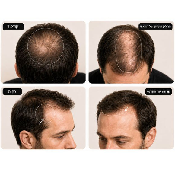 Feature product image